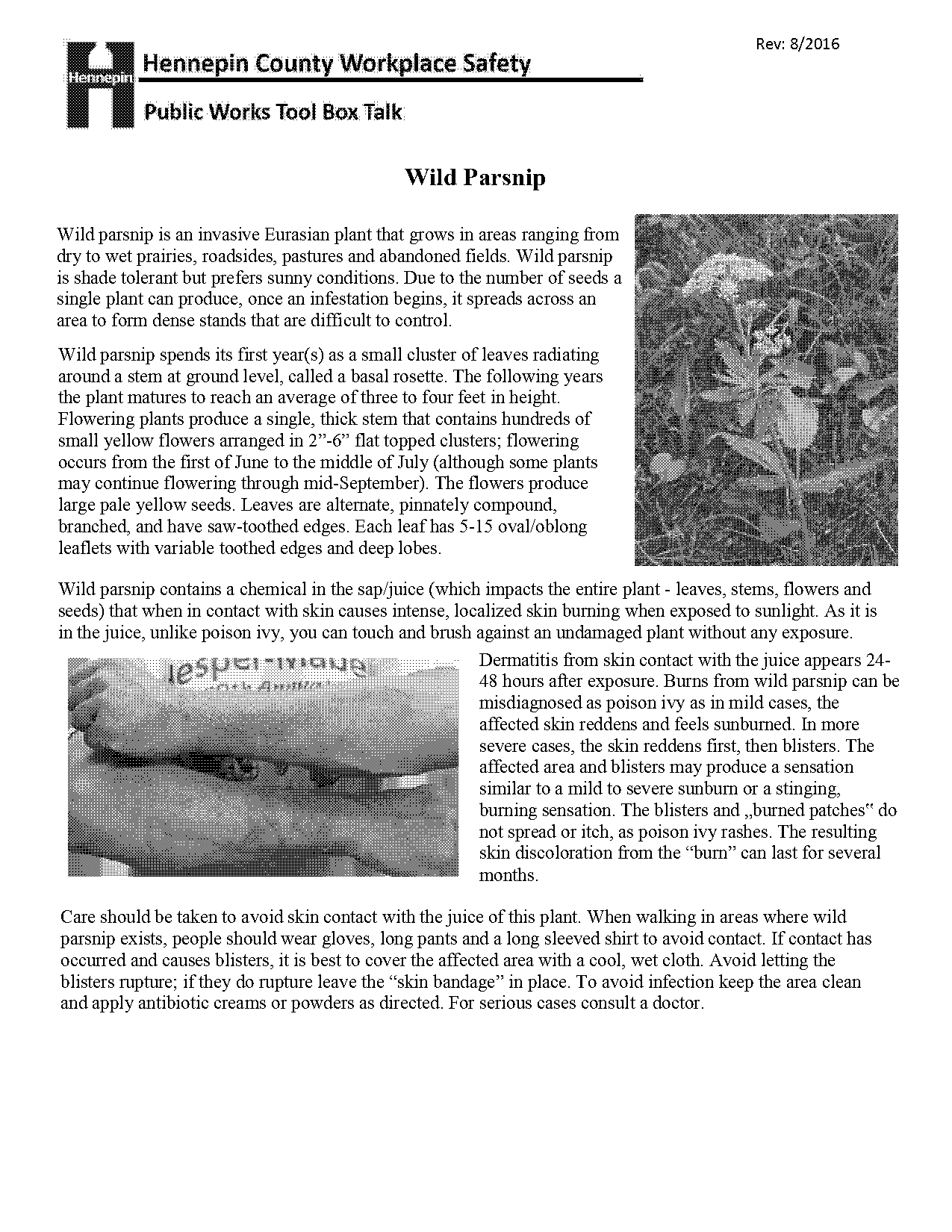 poison parsnip rash treatment instructions patient handout pdf